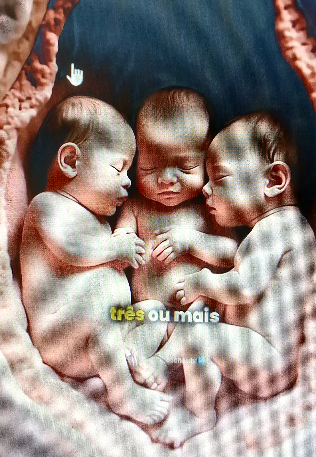 Projeto prevê apoio a gestantes de gravidez múltipla que elas merecem